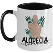 Alopecia Awareness Two Toned Novelty Coffee Mug, mugs - Daily Offers And Steals